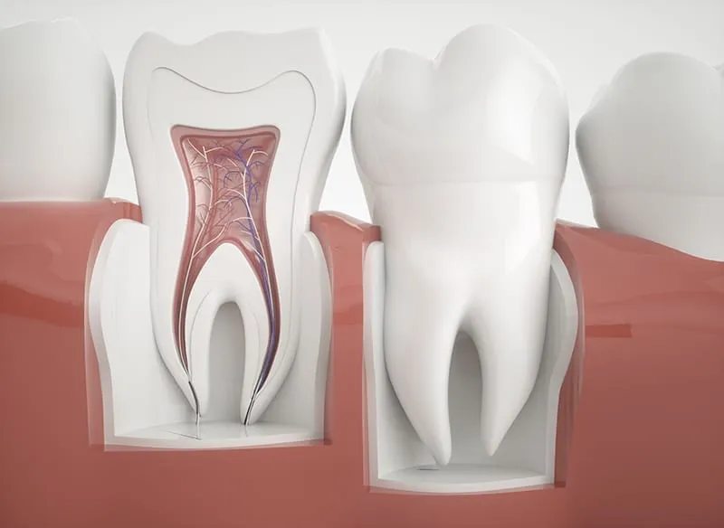 emergency rootcanal 2